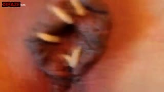 Bei der Frau aus der Fotze kriechen Würmer, Maden und sonstige kriechende Viecher